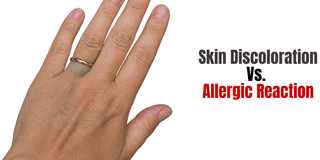Jewelry Turning Your Skin Dark vs. an Allergic Reaction: What’s the Difference?